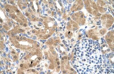 Immunohistochemistry-Paraffin: CCDC112 Antibody [NBP1-59468]