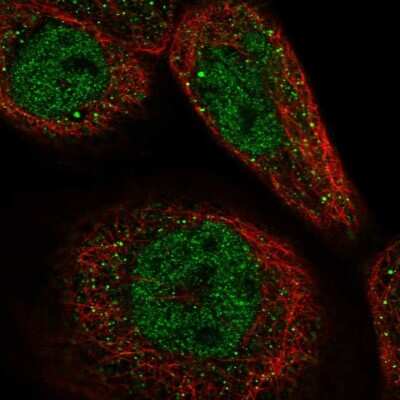 Immunocytochemistry/ Immunofluorescence: CCDC113 Antibody [NBP2-14443]