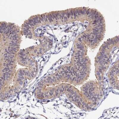 Immunohistochemistry-Paraffin: CCDC113 Antibody [NBP2-14443]