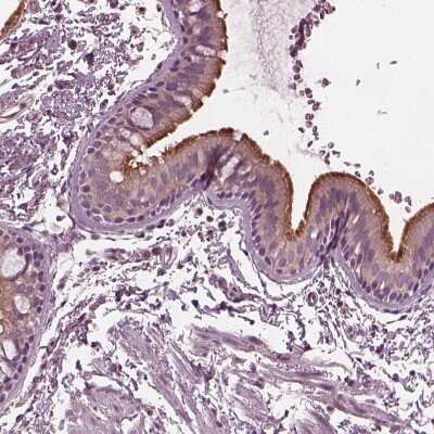 Immunohistochemistry-Paraffin: CCDC114 Antibody [NBP1-93863]