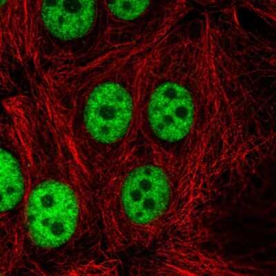 Immunocytochemistry/ Immunofluorescence: CCDC12 Antibody [NBP2-30374]