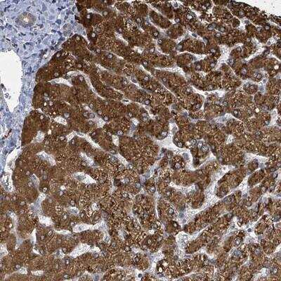 Immunohistochemistry-Paraffin: CCDC121 Antibody [NBP2-14744]