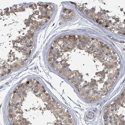 Immunohistochemistry-Paraffin: CCDC121 Antibody [NBP2-14744]