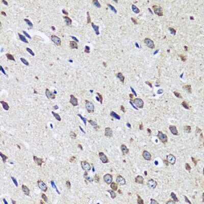 Immunohistochemistry-Paraffin: CCDC124 Antibody - Azide and BSA Free [NBP2-92740]