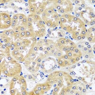 Immunohistochemistry-Paraffin: CCDC124 Antibody - Azide and BSA Free [NBP2-92740]