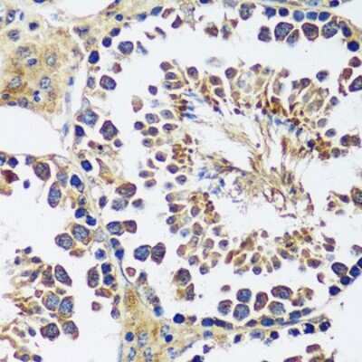 Immunohistochemistry-Paraffin: CCDC124 Antibody - Azide and BSA Free [NBP2-92740]