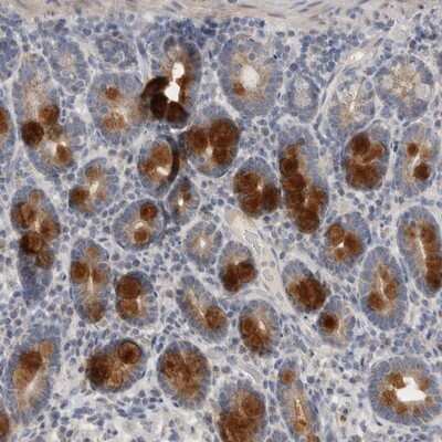 Immunohistochemistry-Paraffin: CCDC126 Antibody [NBP1-82093]