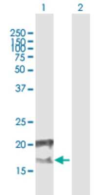 Western Blot: CCDC126 Antibody [H00090693-B01P]