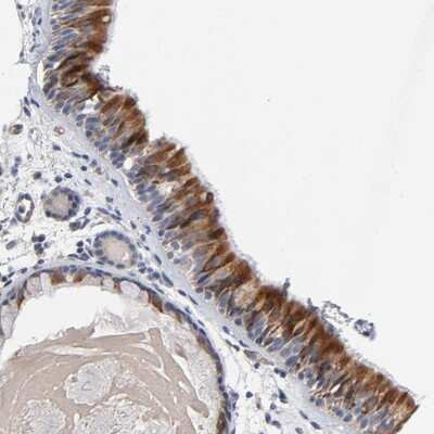 Immunohistochemistry-Paraffin: CCDC134 Antibody [NBP1-82125]