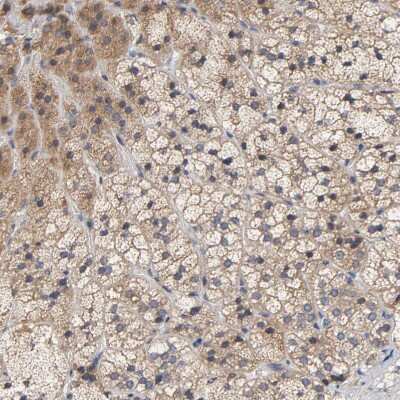 Immunohistochemistry-Paraffin: CCDC134 Antibody [NBP1-82125]