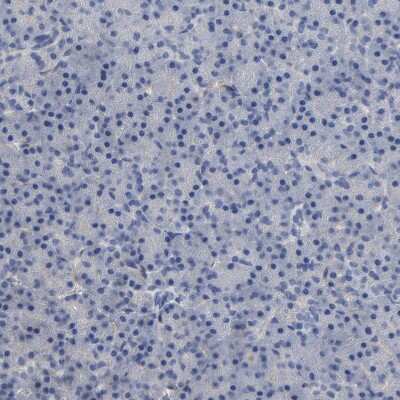 Immunohistochemistry-Paraffin: CCDC134 Antibody [NBP1-82125]