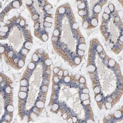 Immunohistochemistry-Paraffin: CCDC134 Antibody [NBP1-82125]