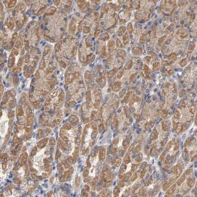 Immunohistochemistry-Paraffin: CCDC134 Antibody [NBP1-82125]