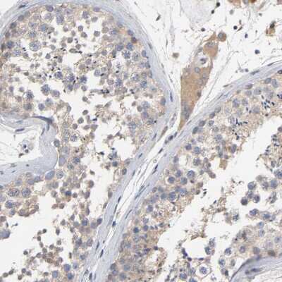 Immunohistochemistry-Paraffin: CCDC134 Antibody [NBP1-82125]