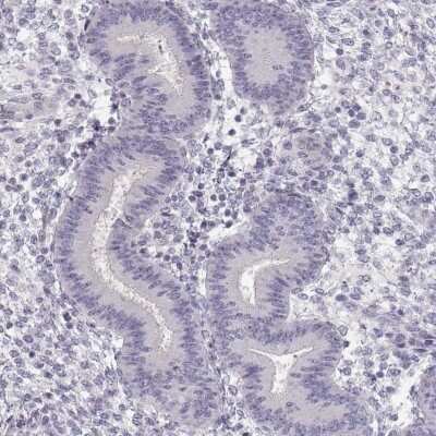 Immunohistochemistry-Paraffin: CCDC136 Antibody [NBP2-58816]