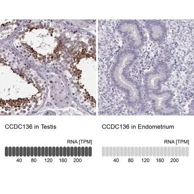 Immunohistochemistry-Paraffin: CCDC136 Antibody [NBP2-58816]
