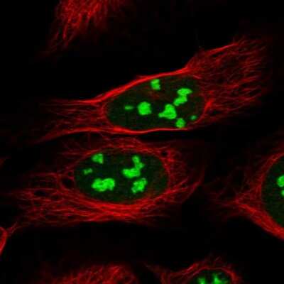 Immunocytochemistry/ Immunofluorescence: CCDC137 Antibody [NBP2-31033]