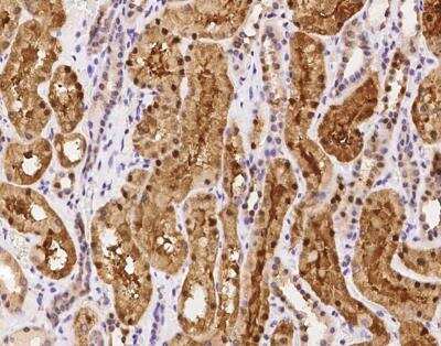 Immunohistochemistry-Paraffin: CCDC137 Antibody [NBP3-12572]