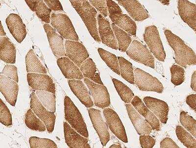 Immunohistochemistry-Paraffin: CCDC137 Antibody [NBP3-12572]