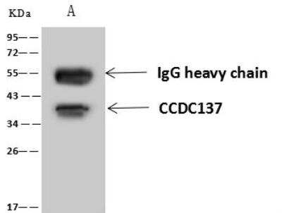 Immunoprecipitation: CCDC137 Antibody [NBP3-12572]