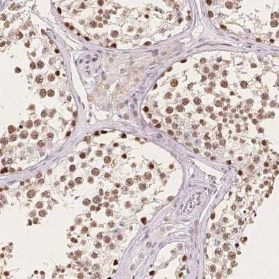Immunohistochemistry: CCDC138 Antibody [NBP2-49123]