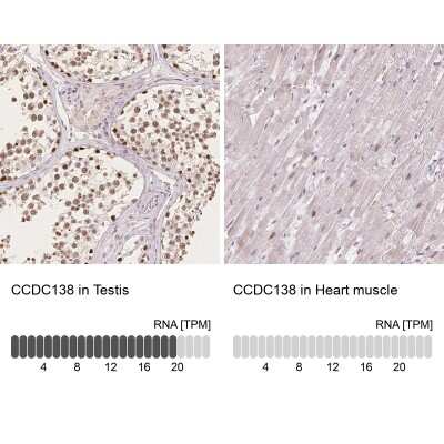 Immunohistochemistry-Paraffin: CCDC138 Antibody [NBP2-49123]