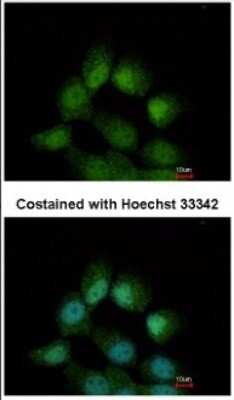 Immunocytochemistry/ Immunofluorescence: CCDC14 Antibody [NBP2-15742]