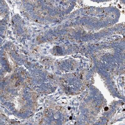 Immunohistochemistry-Paraffin: CCDC146 Antibody [NBP1-86432]
