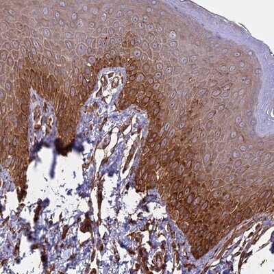 Immunohistochemistry-Paraffin: CCDC148 Antibody [NBP1-81217]