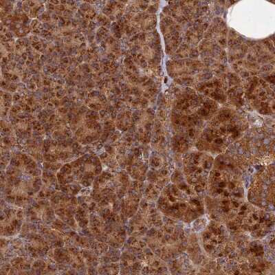 Immunohistochemistry: CCDC150 Antibody [NBP2-33409]