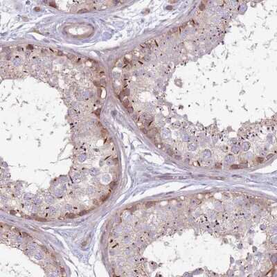 Immunohistochemistry-Paraffin: CCDC150 Antibody [NBP2-33514]