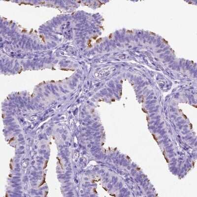 Immunohistochemistry-Paraffin: CCDC151 Antibody [NBP2-49140]