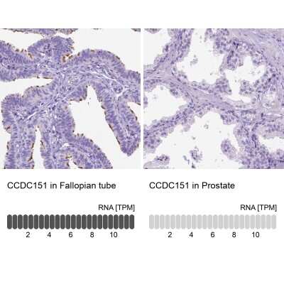 Immunohistochemistry-Paraffin: CCDC151 Antibody [NBP2-49140]