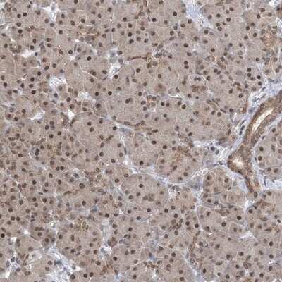 Immunohistochemistry-Paraffin: CCDC152 Antibody [NBP1-93555]