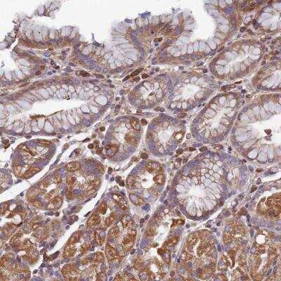 Immunohistochemistry: CCDC153 Antibody [NBP1-93549]