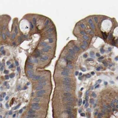 Immunohistochemistry-Paraffin: CCDC155 Antibody [NBP1-81992]