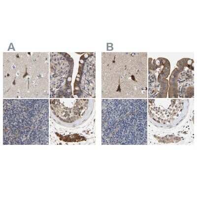 Immunohistochemistry-Paraffin: CCDC155 Antibody [NBP1-81993]