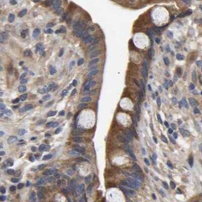 Immunohistochemistry-Paraffin: CCDC155 Antibody [NBP1-81993]