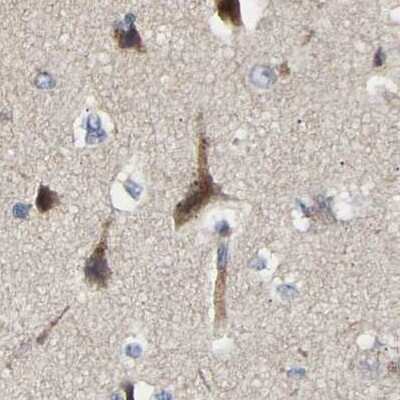 Immunohistochemistry-Paraffin: CCDC155 Antibody [NBP1-81993]