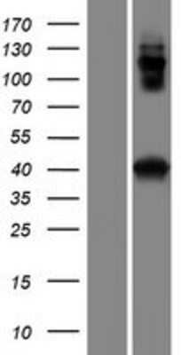 Western Blot: CCDC159 Overexpression Lysate [NBP2-08400]