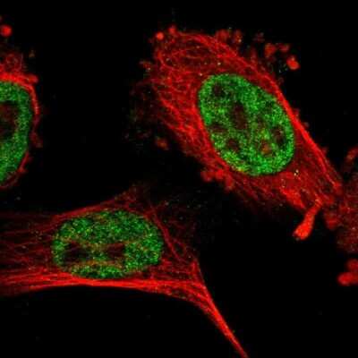 Immunocytochemistry/ Immunofluorescence: CCDC16 Antibody [NBP1-88165]