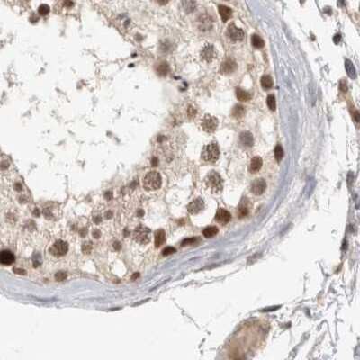 Immunohistochemistry-Paraffin: CCDC16 Antibody [NBP1-88165]
