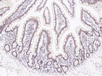 Immunohistochemistry-Paraffin: CCDC16 Antibody [NBP2-97135]