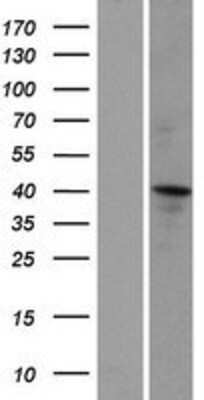 Western Blot: CCDC16 Overexpression Lysate [NBP2-05853]