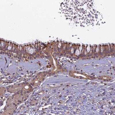 Immunohistochemistry-Paraffin: CCDC167 Antibody [NBP1-94107]