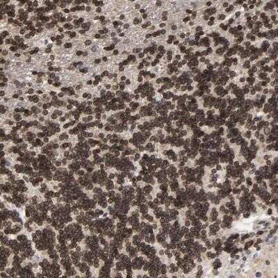Immunohistochemistry-Paraffin: CCDC175 Antibody [NBP1-91111]