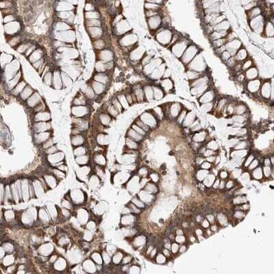 Immunohistochemistry-Paraffin: CCDC18 Antibody [NBP1-82504]