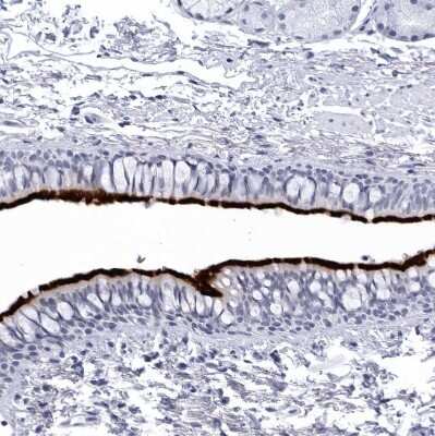 Immunohistochemistry-Paraffin: CCDC181 Antibody [NBP1-93898]
