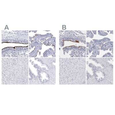 Immunohistochemistry-Paraffin: CCDC181 Antibody [NBP1-93898]