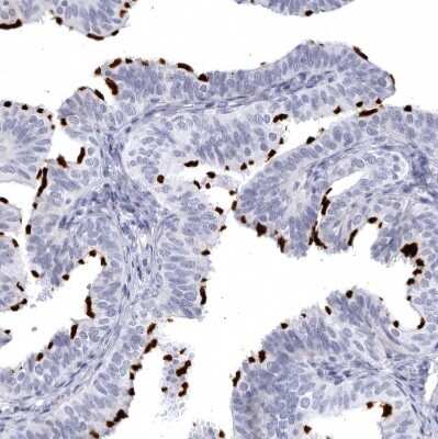 Immunohistochemistry-Paraffin: CCDC181 Antibody [NBP1-93898]